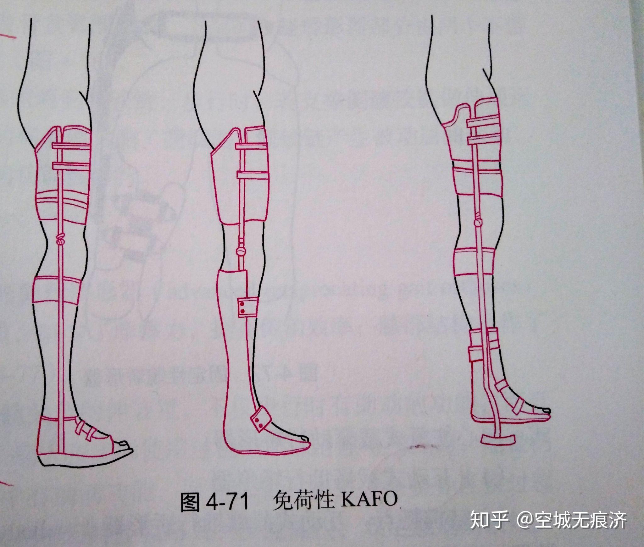 臨床康復工程學 假肢與矯形器的功能、設計與發展